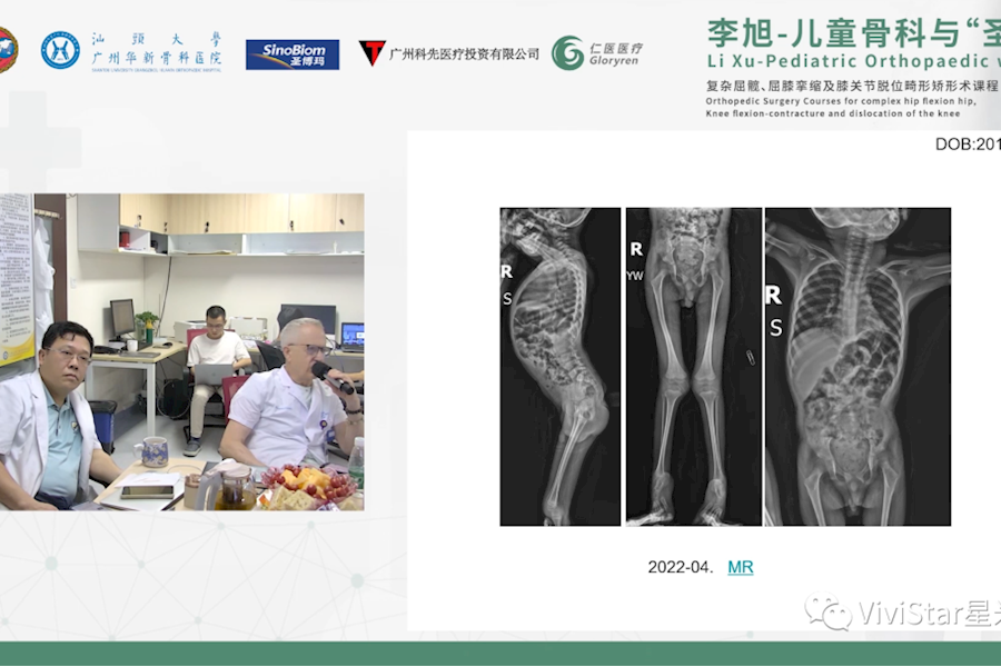 李旭-儿童骨科与